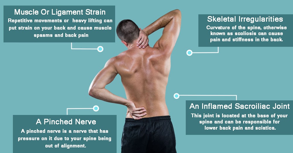 Back Pain Chart