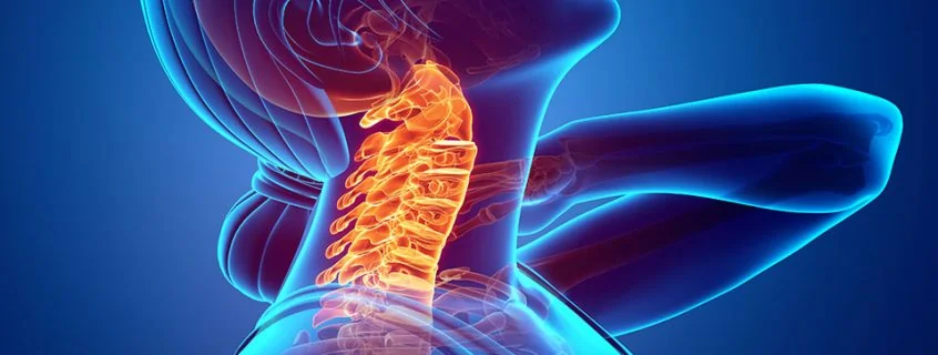 Neck Pain Treatment