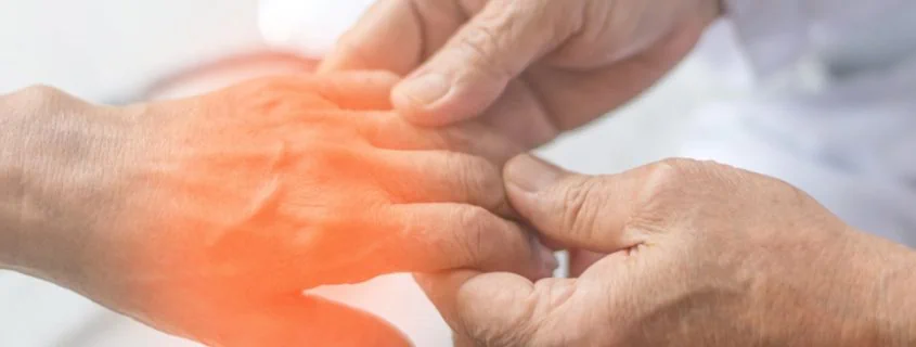 Peripheral Neuropathy