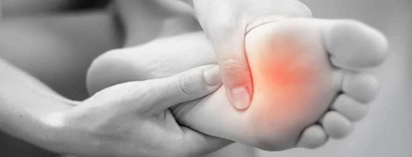 Morton's Neuroma