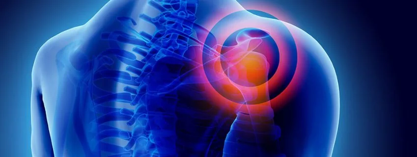 Shoulder Pain