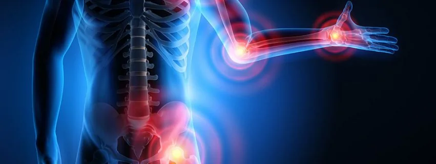 Osteoarthritis - Symptoms, Causes, Treatments