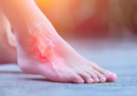 plantar fasciitis treatment