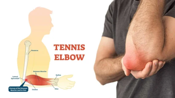 Tennis Elbow From Repetitive Movement